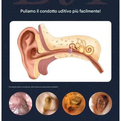 Kit di rimozione della cera dell'orecchio elettrico